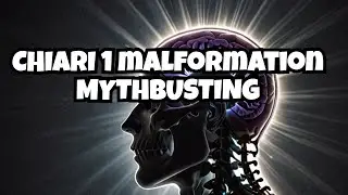 Expert Insights: Chiari 1 Malformation Explained