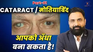 मोतियाबिंद का सही ट्रीटमेंट? What is Cataract? Early Signs, Diagnosis & Best Treatment Options