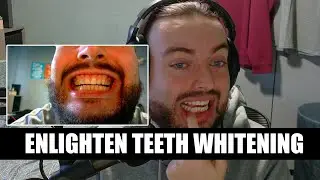UK Enlighten Teeth Whitening:  Experience & Results!