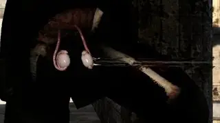 Sniper Elite 3 Nut shot