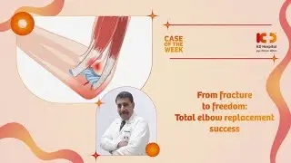 Total Elbow Replacement Success Story | KD Hospital | Dr Parag Shah