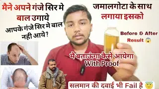 Jamalgota For Hair Treatment l जमालगोटा से गंजे सिर मे उगाये बाल l😱l #jamalgotaforhairtrratment  