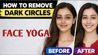 Dark Circles Remove in 7 Days😱 | Dark Circles Hatane Ka Asaan Tarika | Face Yoga That Actually Works