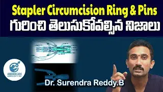 Stapler Circumcision గురించి తెలుసుకోవాల్సిన నిజాలు | Dr Surendra Reddy | Androcare Andrology Clinic