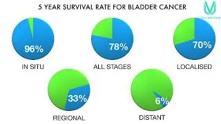 7 Facts of Cancer of Urinary Bladder -- Aware for best care