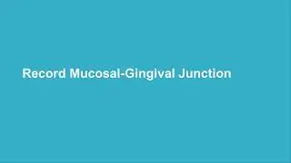R4+:  Using the Periodontal Chart Recorded Class