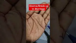 Sign Of Divorce In Marriage/Separation Lines In Hand #astrology #palmistry #divorce #kundali #fact