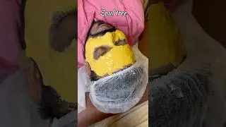 Skin brightening treatment at affordable price #skinbrightening #brightskin #hydrafacial