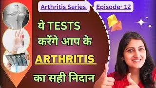 Tests for joint pain #xray #bloodtest #uricacid # rafactor #arthritis #pathyalifecare