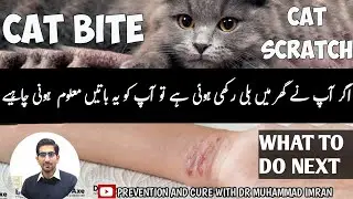 IN CASE CAT SCRATCHES OR BITES WHAT TO DO NEXT?| بلی نے کاٹاIS IT DANGEROUS?| PREVENTION AND CURE