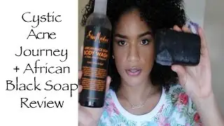 Shea Moisture African Black Soap Review on Cystic Acne-Prone Skin