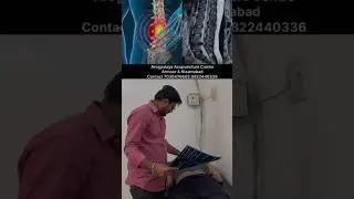 Gym Injury Back Pain? Acupuncture Gave Him Real Relief! | #arogyalaya #healthtipsintelugu #backpain