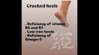 heels#tips #skincare #beautyhacks#pin #@tipsBareerahkhan-z7o #beautytips #totkay #beauty#