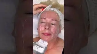 HIFU Ultraformer III Full Face & Neck Treatment