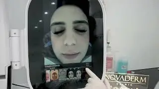 Analyseur de scanner facial 3D pour syst&egrave;me de diagnostic de la peau