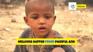 Worms in Your Blood? TheTerrifying Reality of Filarial Infections#facts #dailydoseofhealthyliving#fy