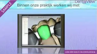 Etkon