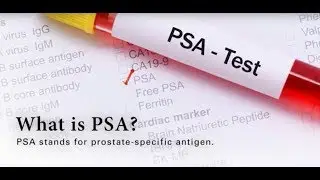 Prostate Cancer Survivor Explains the Importance of Regular PSA Checks