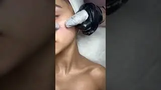 #טיפוח #טיפול #טיקטוק #cosmetics #אקנה #skin -#skincare #skin #cosnime