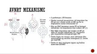 Klinisk EKG: Atrioventrikul&aelig;rnodal reentrytakykardi (AVNRT)