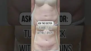 Tummy tuck without drains