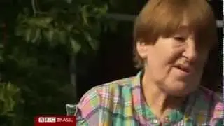 Mulher tem face reconstru&iacute;da em 3D depois de enfrentar grave c&acirc;ncer | Biofabris