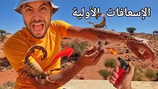 تعلم كيفية.إسعاف لدغة العقارب السامة 👌🦂🦂