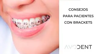 Consejos y cuidados si te acaban de poner los brackets | Clínica dental en Alcobendas Avodent