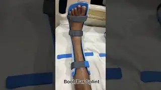 Boot Bar / Derotation Bar #shortsfeed #shortvideo #shorts #short #orthotics #ortho