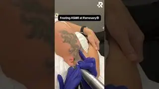 ASMR Tattoo Removal ❄️ #asmr #removery