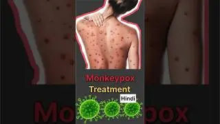 Monkeypox treatment #monkeypoxtreatment #health