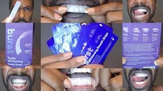 Unbelievable Results! @BURSTOralCareTV Whitening Breath Strips Test & Review (FULL VIDEO)