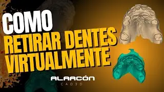 COMO RETIRAR DENTES VIRTUALMENTE #dentista #exocad #fluxodigital #