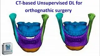 CT based Unsupervised DL for orthognathic surgery
