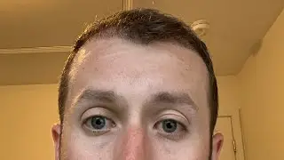 Day 92 - 13 Week Results - FUE Hair Transplant - Excited To Trim My New Hair