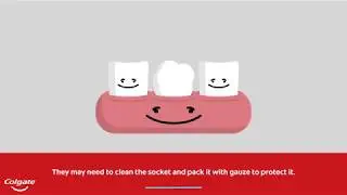 Tooth Removal - Preventing Dry Socket | Colgate&reg;