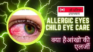 ALLERGY OF EYES।CHILD EYE CARE।VISION SCREENING। आंख में एलर्जी। बच्चों में कैसे करे बचाव।  देखभाल।