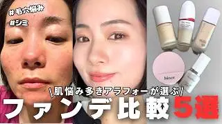 【ファンデ難民必見】毛穴・シミ・ニキビ悩みの40代が徹底調査｜正直レビュー5選