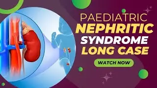 Nephritic Syndrome - Paediatric Long case discussion MBBS