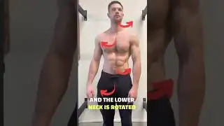 Why Your Spine Is Predicatably Twisted & Asymmetrical #posture #scoliosistreatment #backpain #pain