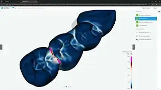 Simq Dental 0.5.1 - exocad integration
