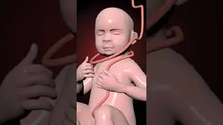 Nuchal cord-baby face a dangerous situation inside the womb (3D Animation)