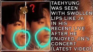 Ого!😱💋Тэхён был замечен с опухшими губами, как у Чонгука, на его недавнем концерте после того, ка...