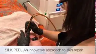 Silk Peel