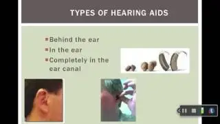 Chapter 13: Amplification and Sensory Systems