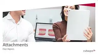 3Shape Design Service - Attachments for Clear Aligners