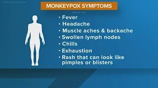 Two cases of monkeypox confirmed, San Antonio Metro Health says. | List of symptoms