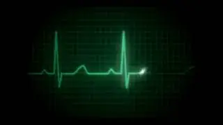 Heartbeat flatline new 2023