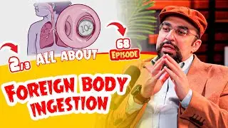 Ep 68 ALL about Foreign body ingestion (2 of 3) in children- Dr Khaled salah