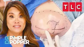 All the Pops from Season 9 Part 1 | Dr. Pimple Popper | TLC